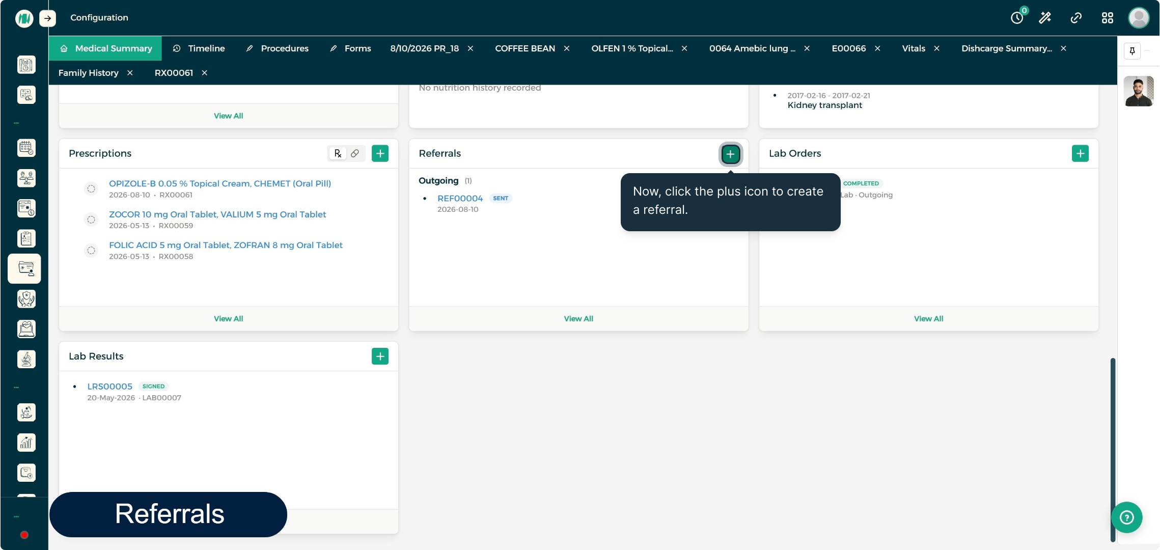 Step 1 - Add a New Referral